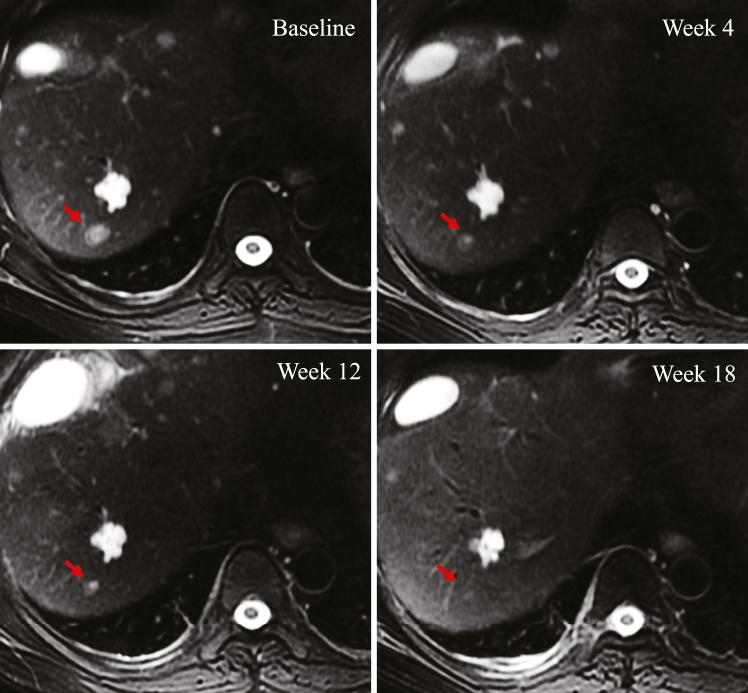 Fig. 4