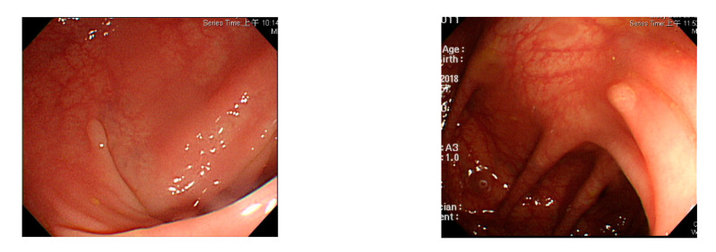 Figure 17