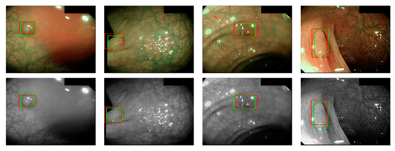 Figure 11