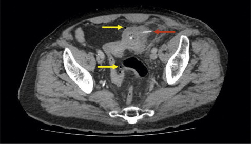 Fig. 1