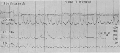 FIG. 5