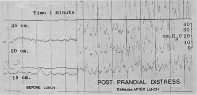 FIG. 6