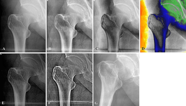 Fig. 1A–G