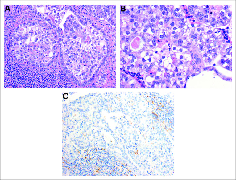 FIG 3.