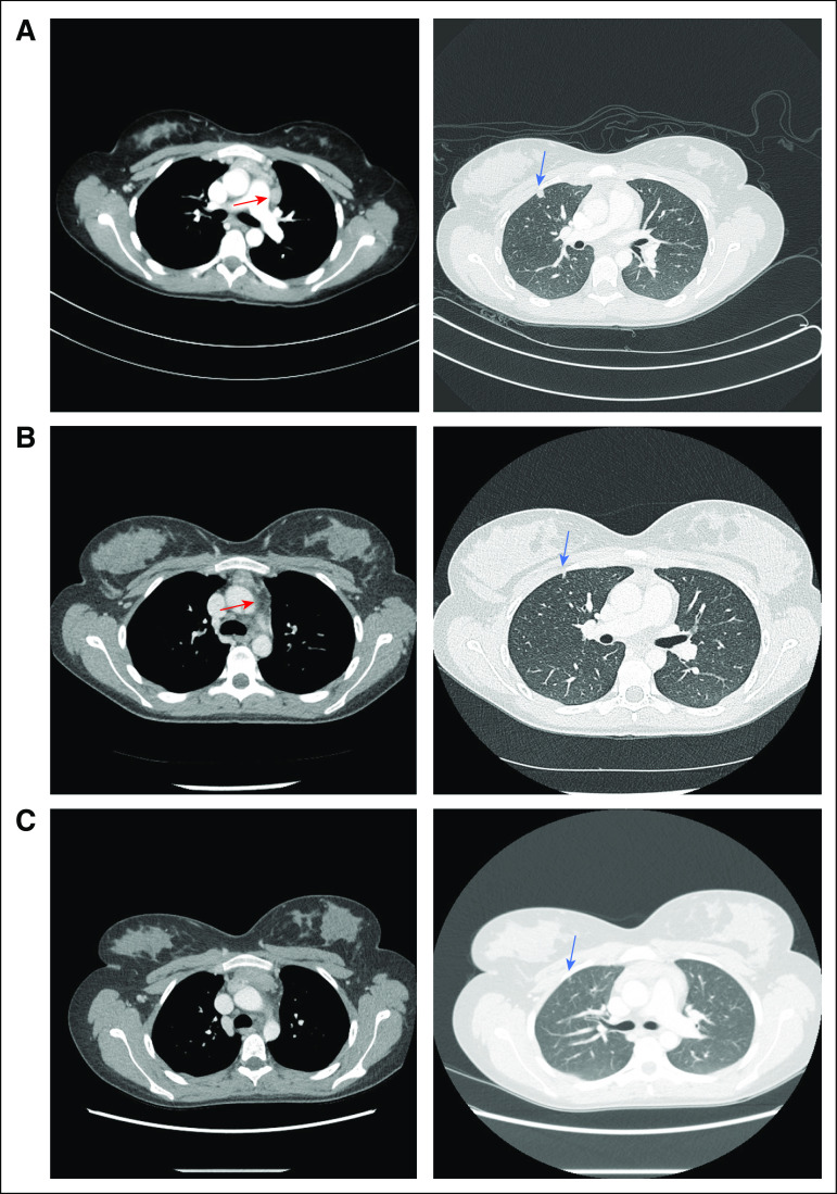 FIG 2.