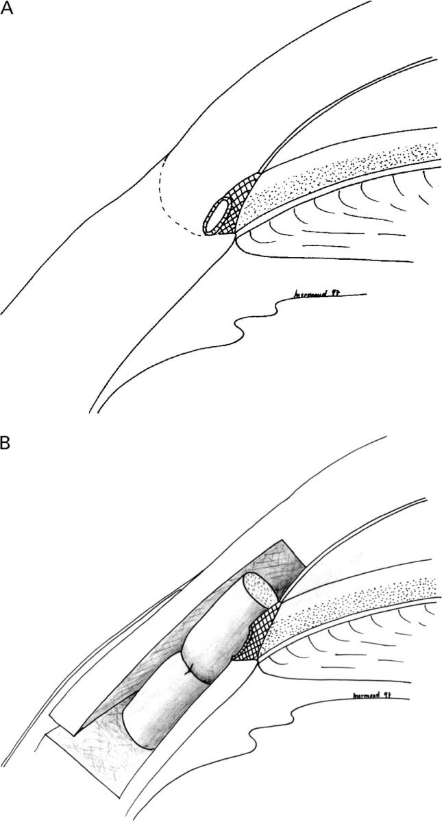 Figure 1  