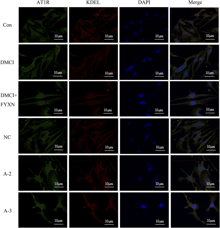 FIGURE13