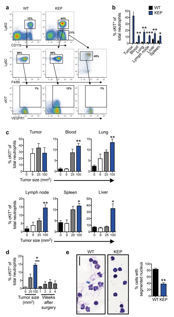 IL17-producing γδ T cells and neutrophils conspire to promote breast ...