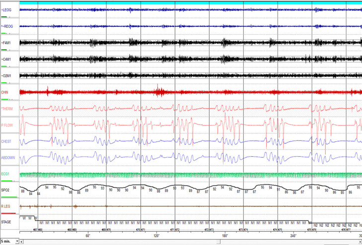 Figure 11