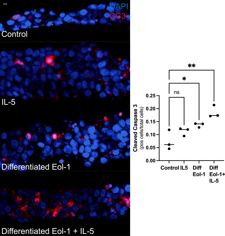 Figure 11