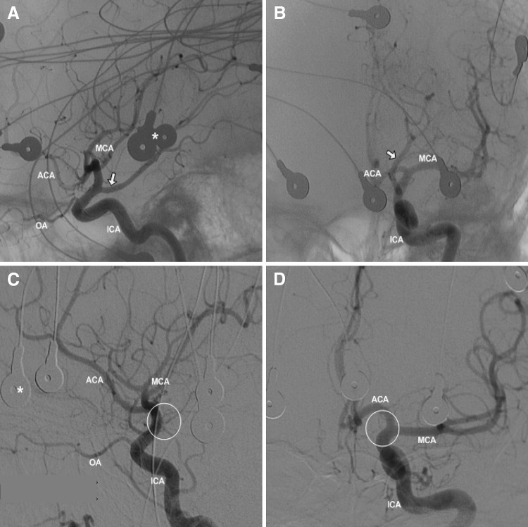 Fig. 1