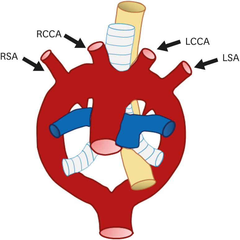 Figure 21