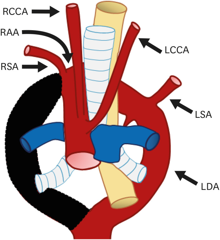 Figure 19