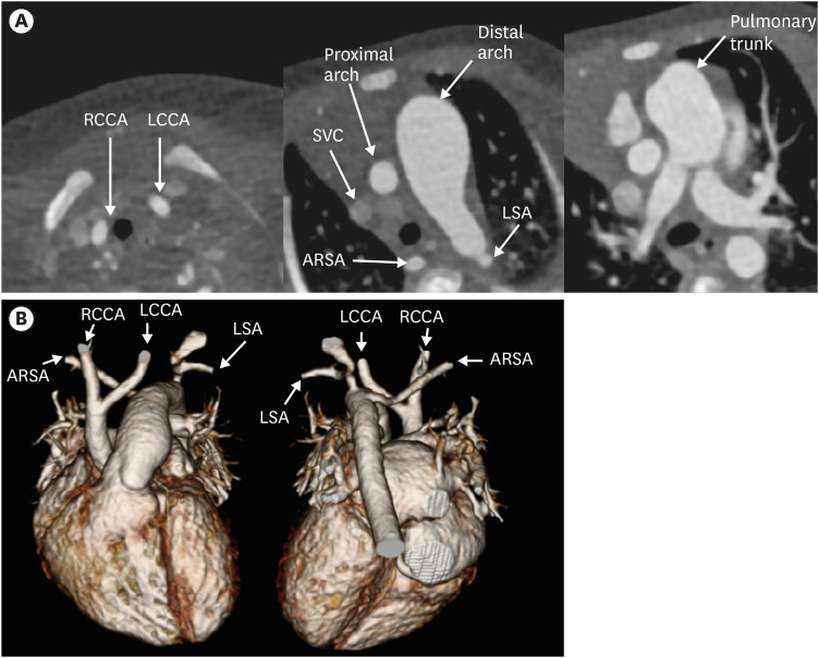 Figure 26