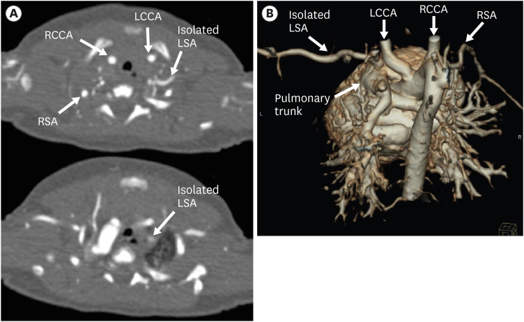 Figure 18