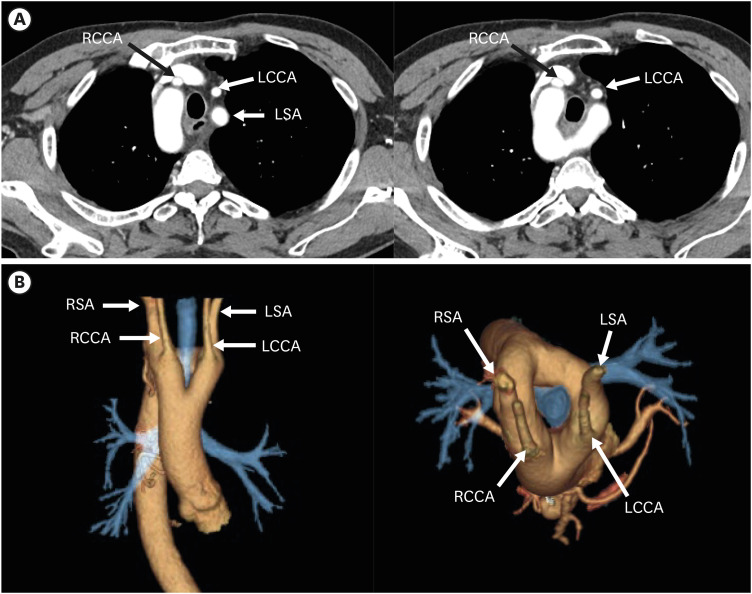 Figure 22