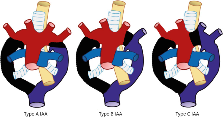 Figure 25