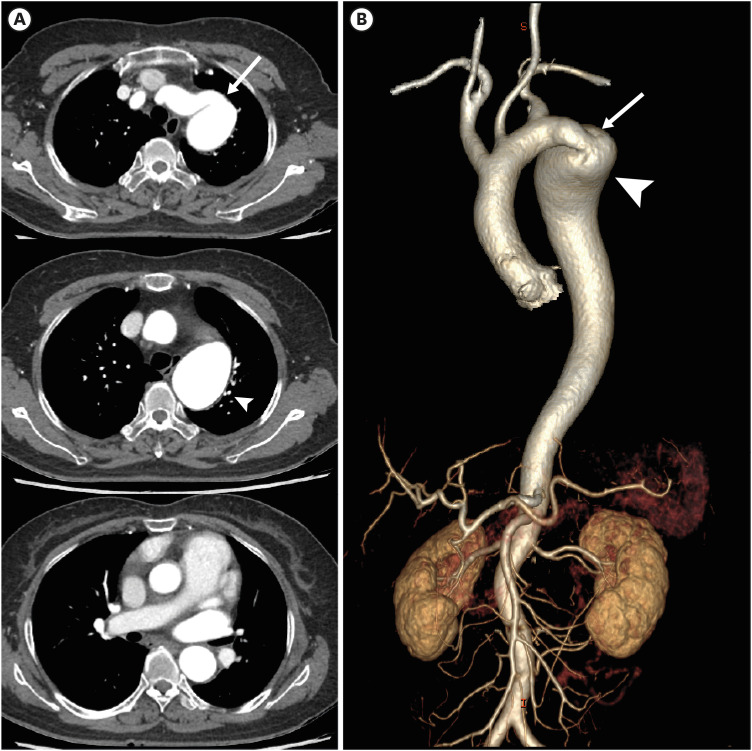 Figure 28