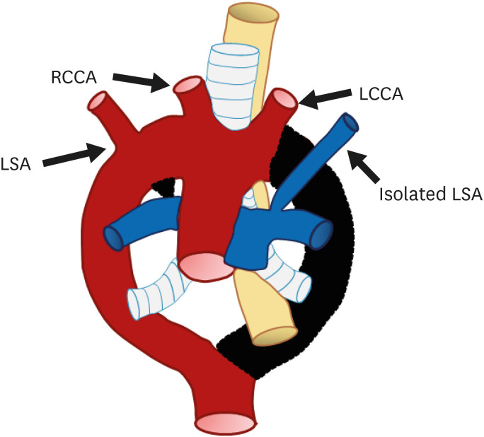 Figure 17