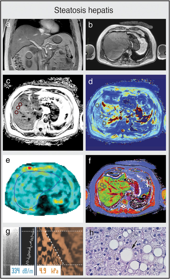 FIGURE 3