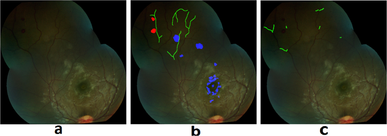 Figure 14