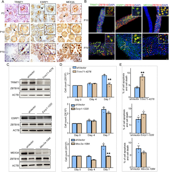 Fig. 4. Localization of TRIM71, ESRP1 and MEX3A expression in mouse testes. (A) Representative images of immunohistochemical staining for TRIM71, ESRP1 and MEX3A in cross-sections of mouse testes during neonatal (P3), prepubertal (P10) and adult (P70) stages of development. Insets show magnification of the area where the positive cells are located. Arrowheads indicate the positive cells. (B) Whole-mount immunofluorescence staining for TRIM71, ESRP1 and MEX3A expression in undifferentiated spermatogonia based on colocalization with the marker ZBTB16. Insets show magnification of the area where the positive cells are located. (C) Representative images of western blot analysis for knockdown efficiency of TRIM71, ESRP1 and MEX3A levels 7 days after gene-specific shRNA treatment compared with non-targeting shRNA control (shVector). ACTB level was assessed as a loading control. (D) Quantification of total cell number in primary cultures of undifferentiated spermatogonia at 0, 4 and 7 days after treatment with Trim71, Esrp1 or Mex3a shRNA to knock down expression. (E) Quantification of apoptotic and dead cells in primary cultures of undifferentiated spermatogonia at 7 days after treatment with Trim71, Esrp1 or Mex3a shRNA. All data are mean±s.e.m. for n=3 different cultures. *P<0.05, **P<0.01 (Student's t-test). Scale bars: 20 μm.