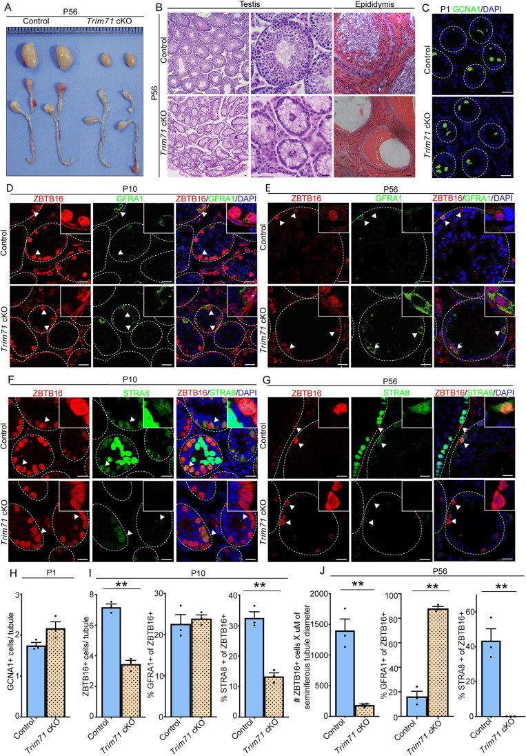 Fig. 5. Impact of Trim71 conditional knockout in the male germline. (A) Representative images of testis and epididymis from adult (P56) Trim71 conditional knockout (cKO) and control mice. Ruler shows 1 mm per division. (B) Representative images of Hematoxylin and Eosin (H&E)-stained cross-sections of seminiferous tubules and epididymis from P56 control and Trim71 cKO mice. (C-G) Representative images of immunofluorescence staining for the pan germ cell marker GCNA1 at P1 (C), the undifferentiated spermatogonial marker ZBTB16 and primitive spermatogonial marker GFRA1 at P10 (D) and P56 (E), and the undifferentiated spermatogonial marker ZBTB16 and differentiating marker STRA8 at P10 (F) and P56 (G) in cross-sections of testes from control and Trim71 cKO mice. (H) Quantification of total germ cell number (based on GCNA1+ cells) in seminiferous tubule cross-sections from control and Trim71 cKO mice at P1. (I,J) Quantification of undifferentiated spermatogonial number [based on ZBTB16+ cells/seminiferous tubule at P10 or number (#) of ZBTB16+ cells × seminiferous tubule diameter (µm) at P56], percentage of the population that is the most primitive subset (based on GFRA1+ among ZBTB16+ cells), and percentage of the population that has transitioned to a differentiating state (based on STRA8+ among ZBTB16+ cells) in cross-sections of testes from control and Trim71 cKO mice at prepubertal (P10) (I) and adult (P56) (J) age points. Data in H-J are mean±s.e.m. for n=3 different mice, dots represent average values of individual mice, **P<0.01 (Student's t-test). Scale bars: 20 μm.