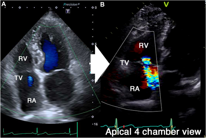 Figure 2