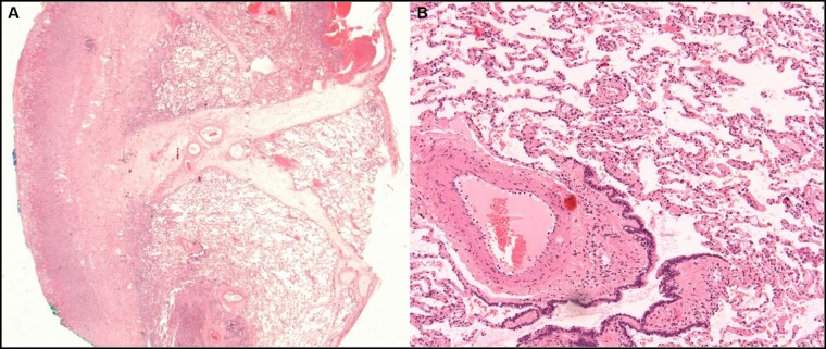 Figure 2: