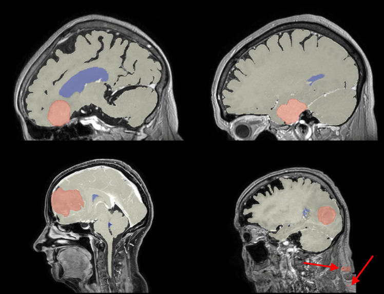 Fig. 2