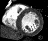 Figure 2d:
