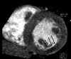 Figure 2b: