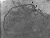 Figure 3c: