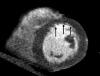 Figure 3b: