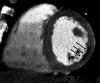 Figure 1b: