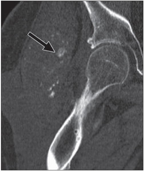 Fig. 17