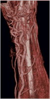 Fig. 20
