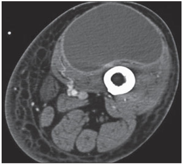 Fig. 13