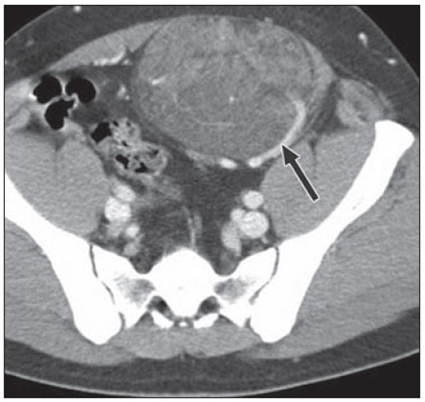 Fig. 21