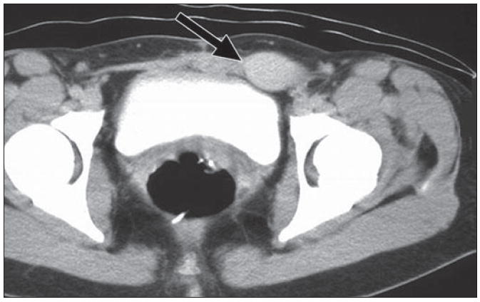 Fig. 15