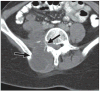 Fig. 18