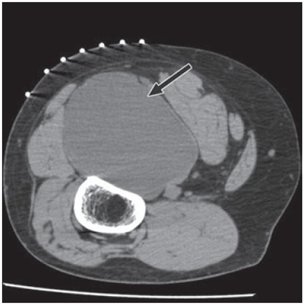 Fig. 14