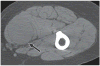Fig. 16