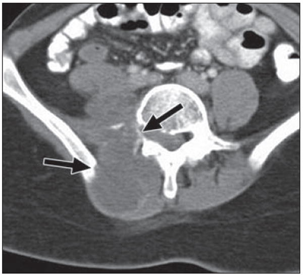 Fig. 18