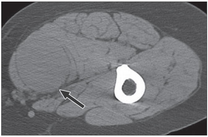 Fig. 16