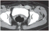 Fig. 15