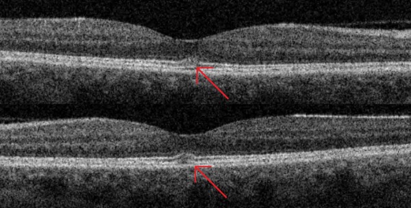 Figure 2