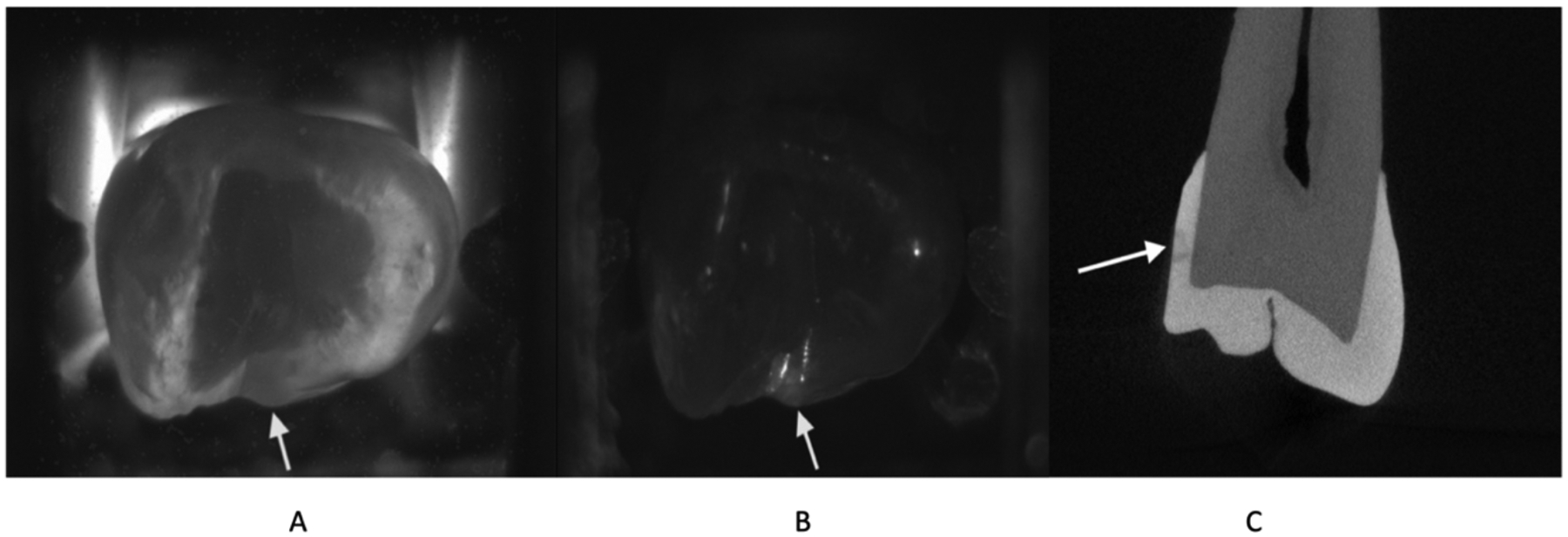 Fig 5.