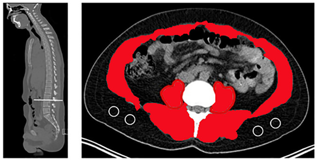 Figure 1