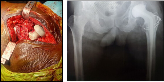 A close up of a human body AI-generated content may be incorrect.